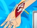 Spill Arm surgery 2
