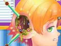Spill Funny Ear Surgery