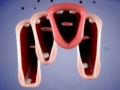 Spill Crazy Lips