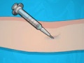 Spill  Operate Now: Eardrum Surgery