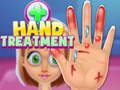 Spill Hand Treatment