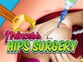 Spill Princess Hips Surgery
