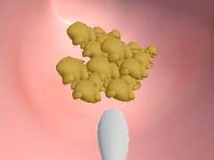 Spill Earwax Clinic
